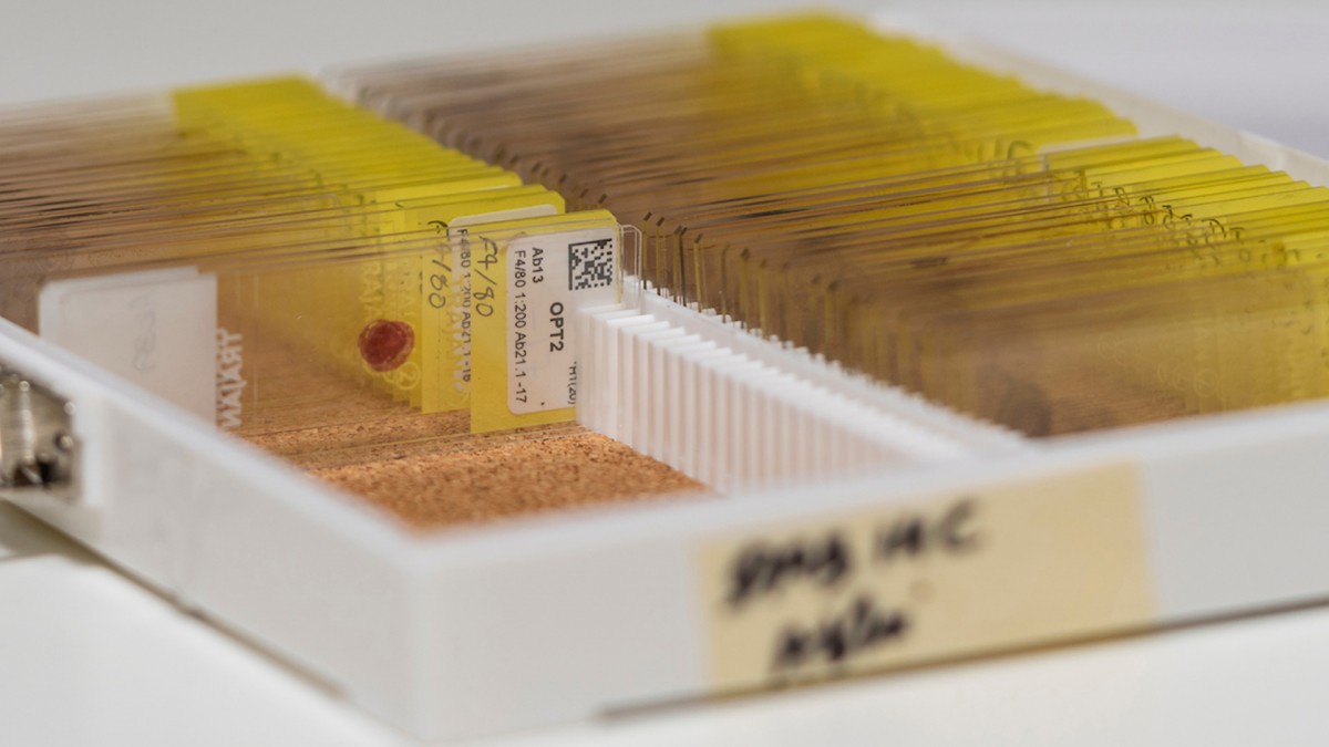 ANU scientists used mouse colon tissue samples to conduct their research. Photo: Jamie Kidston/ANU