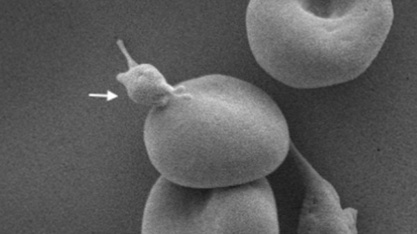 Platelet-red blood cell complex, in which a platelet (arrow) is attached to the surface of a red cell, viewed using scanning electron microscopy (bar length = 1 µm)
